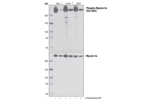 Western Blotting Image 1: Phospho-Myosin IIa (Ser1943) Antibody