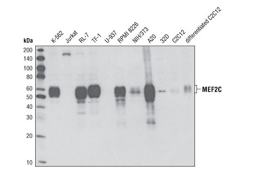  Image 11: Late-Onset Alzheimer's Disease Risk Gene (Mouse Model) Antibody Sampler Kit
