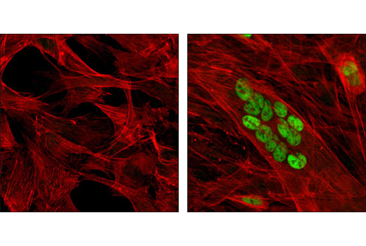  Image 9: Cardiogenesis Marker Antibody Sampler Kit