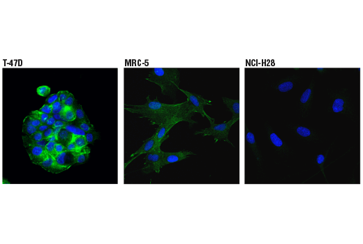 Immunofluorescence Image 1: EPLIN (D1A7A) Rabbit mAb