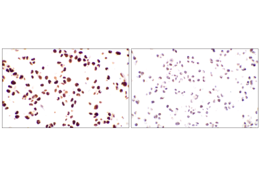 Immunohistochemistry Image 2: DNMT1 (D63A6) XP® Rabbit mAb (BSA and Azide Free)