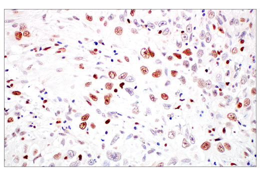 Immunohistochemistry Image 3: DNMT1 (D63A6) XP® Rabbit mAb (BSA and Azide Free)