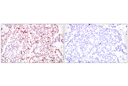 Immunohistochemistry Image 4: DNMT1 (D63A6) XP® Rabbit mAb (BSA and Azide Free)