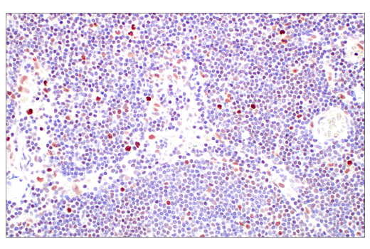 Immunohistochemistry Image 5: DNMT1 (D63A6) XP® Rabbit mAb (BSA and Azide Free)