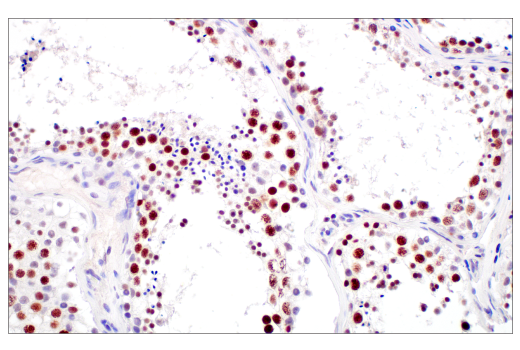 Immunohistochemistry Image 7: DNMT1 (D63A6) XP® Rabbit mAb (BSA and Azide Free)