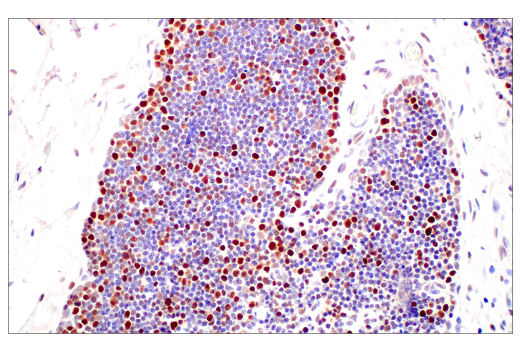 Immunohistochemistry Image 8: DNMT1 (D63A6) XP® Rabbit mAb (BSA and Azide Free)