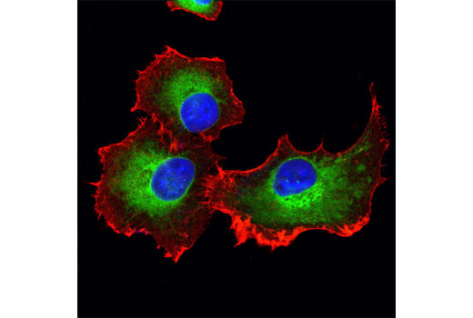 Immunofluorescence Image 1: ERp72 (D70D12) XP® Rabbit mAb