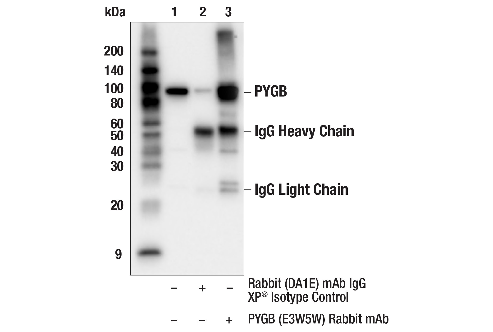 Immunoprecipitation Image 1: PYGB (E3W5W) Rabbit mAb