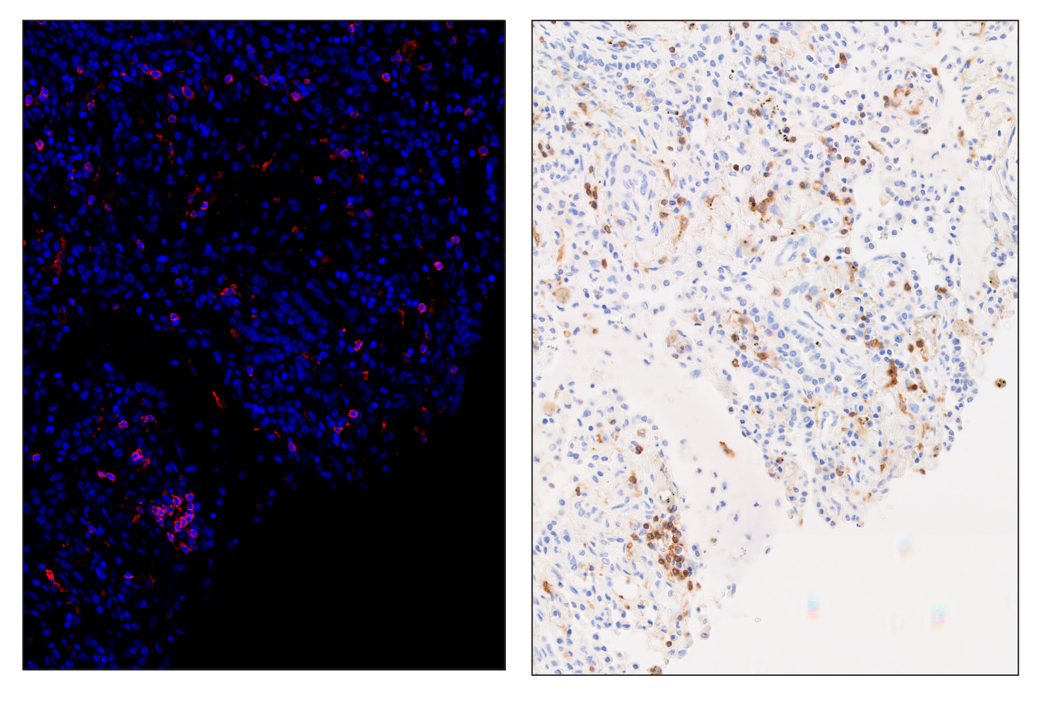 Immunohistochemistry Image 5: CD28 (D2Z4E) & CO-0081-488 SignalStar™ Oligo-Antibody Pair