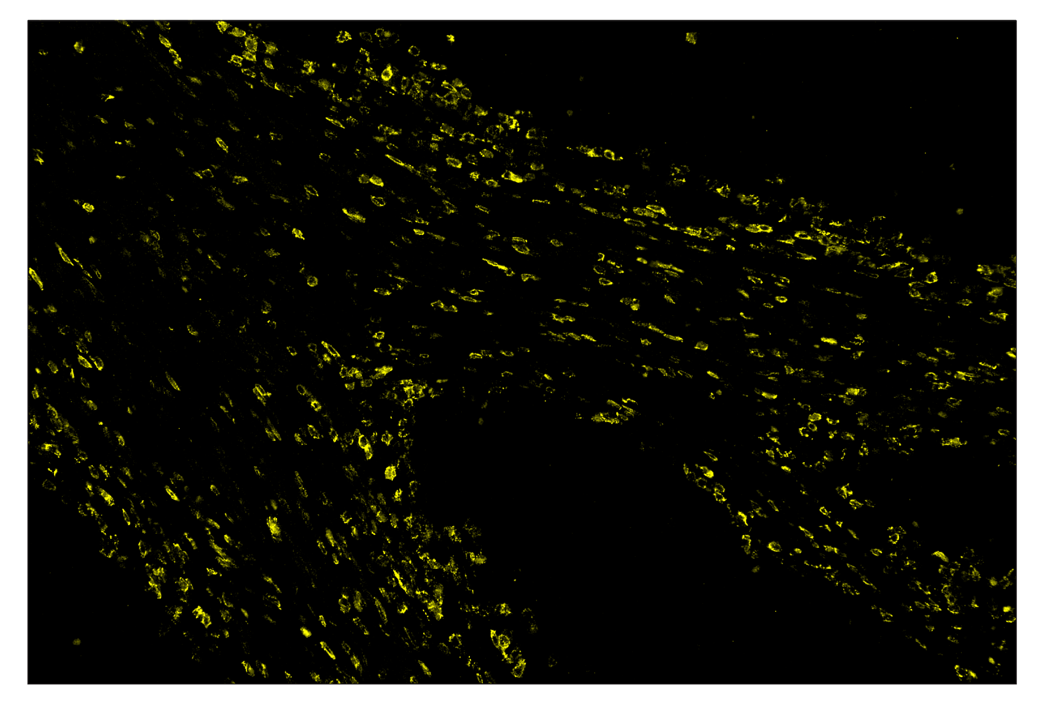 Immunohistochemistry Image 3: CD28 (D2Z4E) & CO-0081-488 SignalStar™ Oligo-Antibody Pair