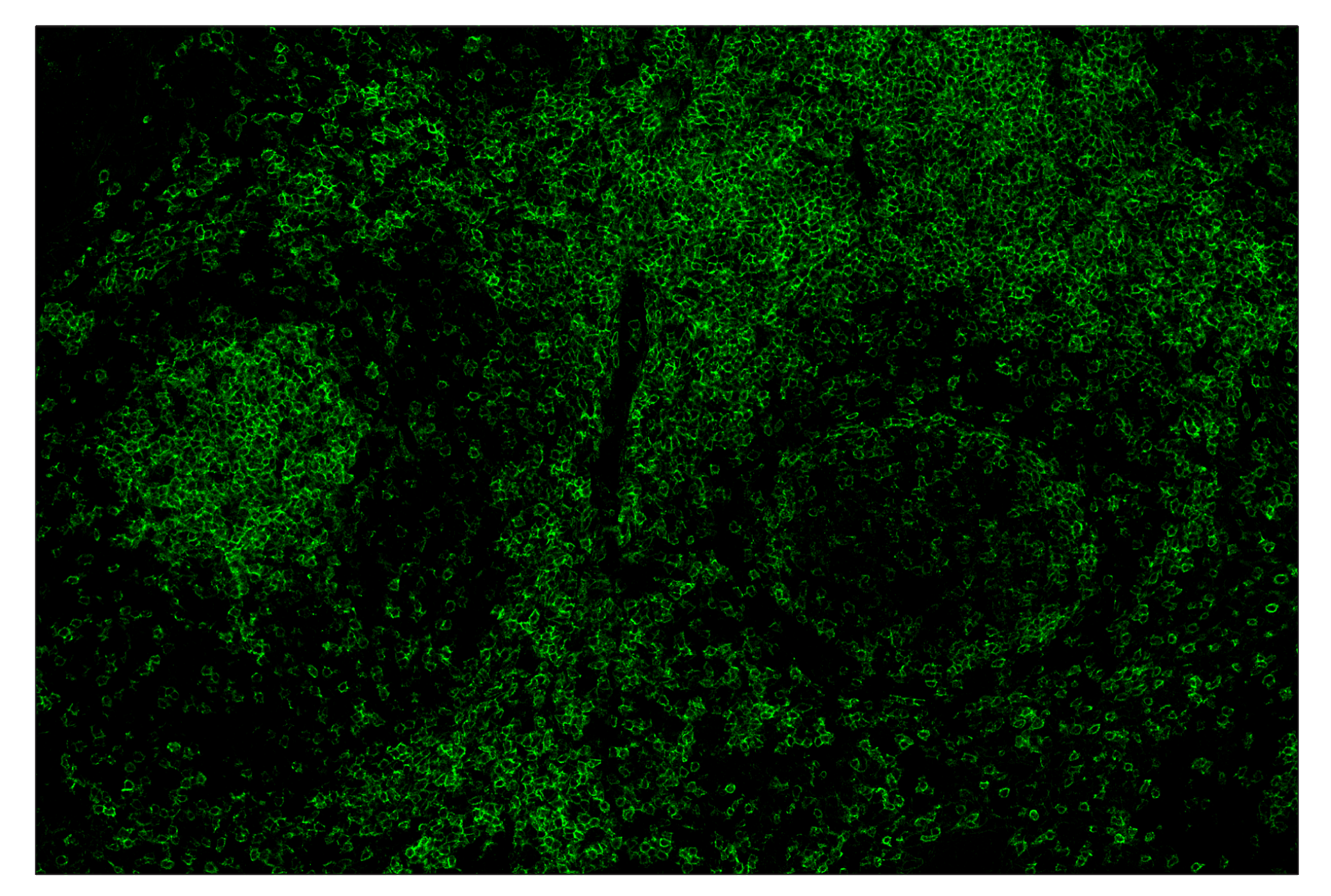 Immunohistochemistry Image 2: CD28 (D2Z4E) & CO-0081-488 SignalStar™ Oligo-Antibody Pair