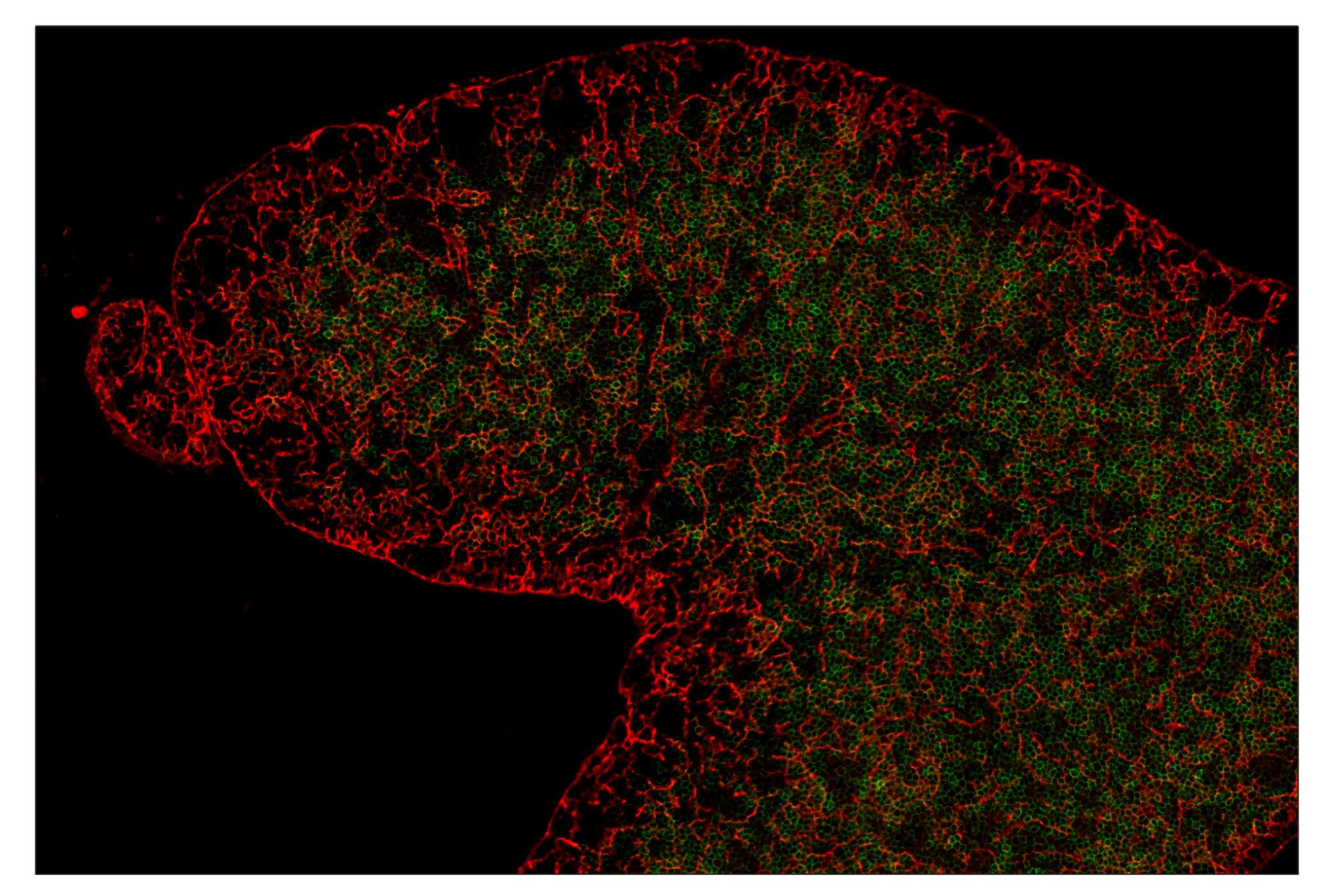 Immunohistochemistry Image 6: CD28 (D2Z4E) & CO-0081-488 SignalStar™ Oligo-Antibody Pair