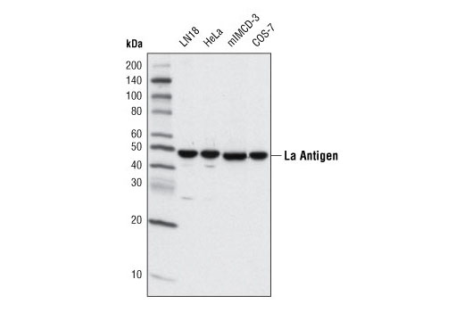 Western Blotting Image 1: La Antigen (D19B3) Rabbit mAb