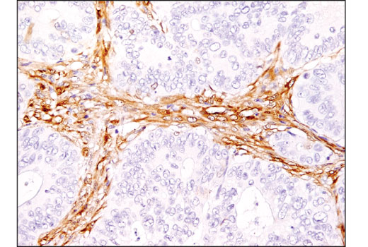 Immunohistochemistry Image 1: HSP27 (E1J4D) Rabbit mAb