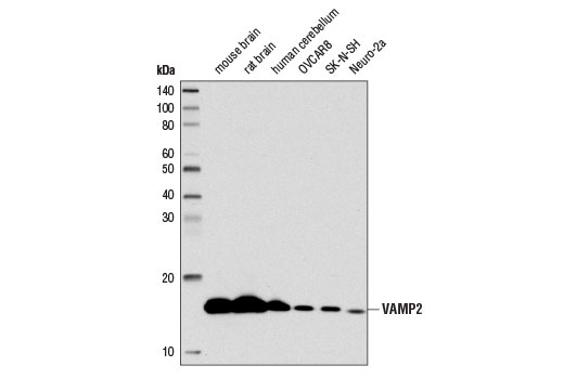 Western Blotting Image 1: VAMP2 (D6O1A) Rabbit mAb (BSA and Azide Free)