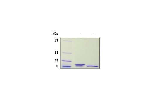  Image 2: Human IL-15 Recombinant Protein