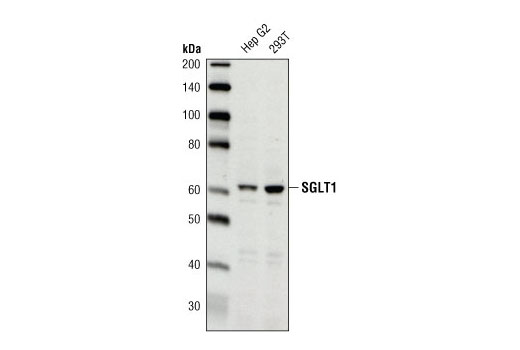 Western Blotting Image 1: SGLT1 Antibody