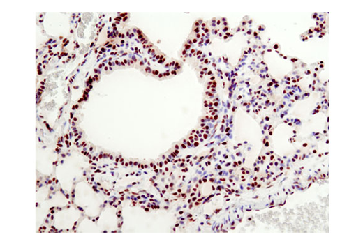 Immunohistochemistry Image 1: HMGB1 (D3E5) Rabbit mAb (BSA and Azide Free)