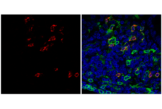 Immunofluorescence Image 3: CTLA-4 (E5S7E) Rabbit mAb