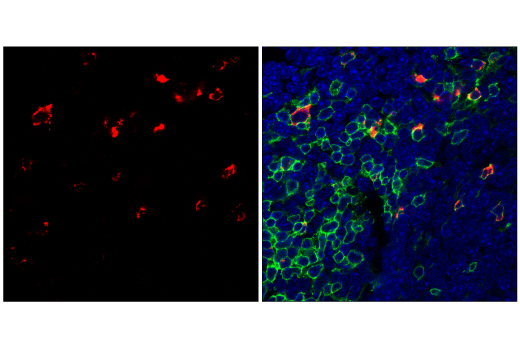 Immunofluorescence Image 1: CTLA-4 (E5S7E) Rabbit mAb