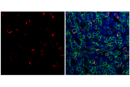 Immunofluorescence Image 2: CTLA-4 (E5S7E) Rabbit mAb