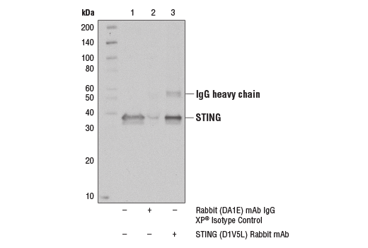 Immunoprecipitation Image 1: STING (D1V5L) Rabbit mAb