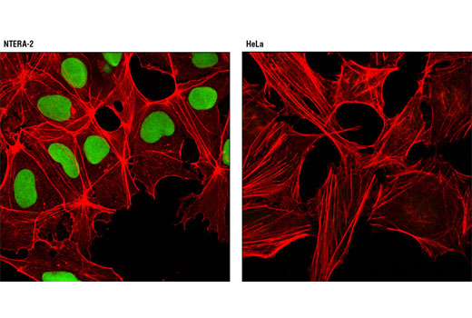Immunofluorescence Image 1: Sox2 (D6D9) XP® Rabbit mAb (Alexa Fluor® 488 Conjugate)