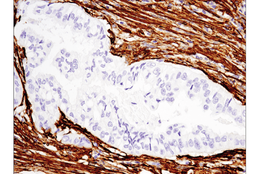 Immunohistochemistry Image 4: α-Smooth Muscle Actin (D4K9N) XP® Rabbit mAb (BSA and Azide Free)
