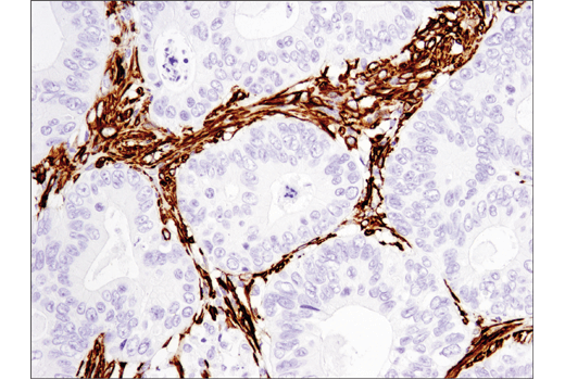 Immunohistochemistry Image 6: α-Smooth Muscle Actin (D4K9N) XP® Rabbit mAb (BSA and Azide Free)