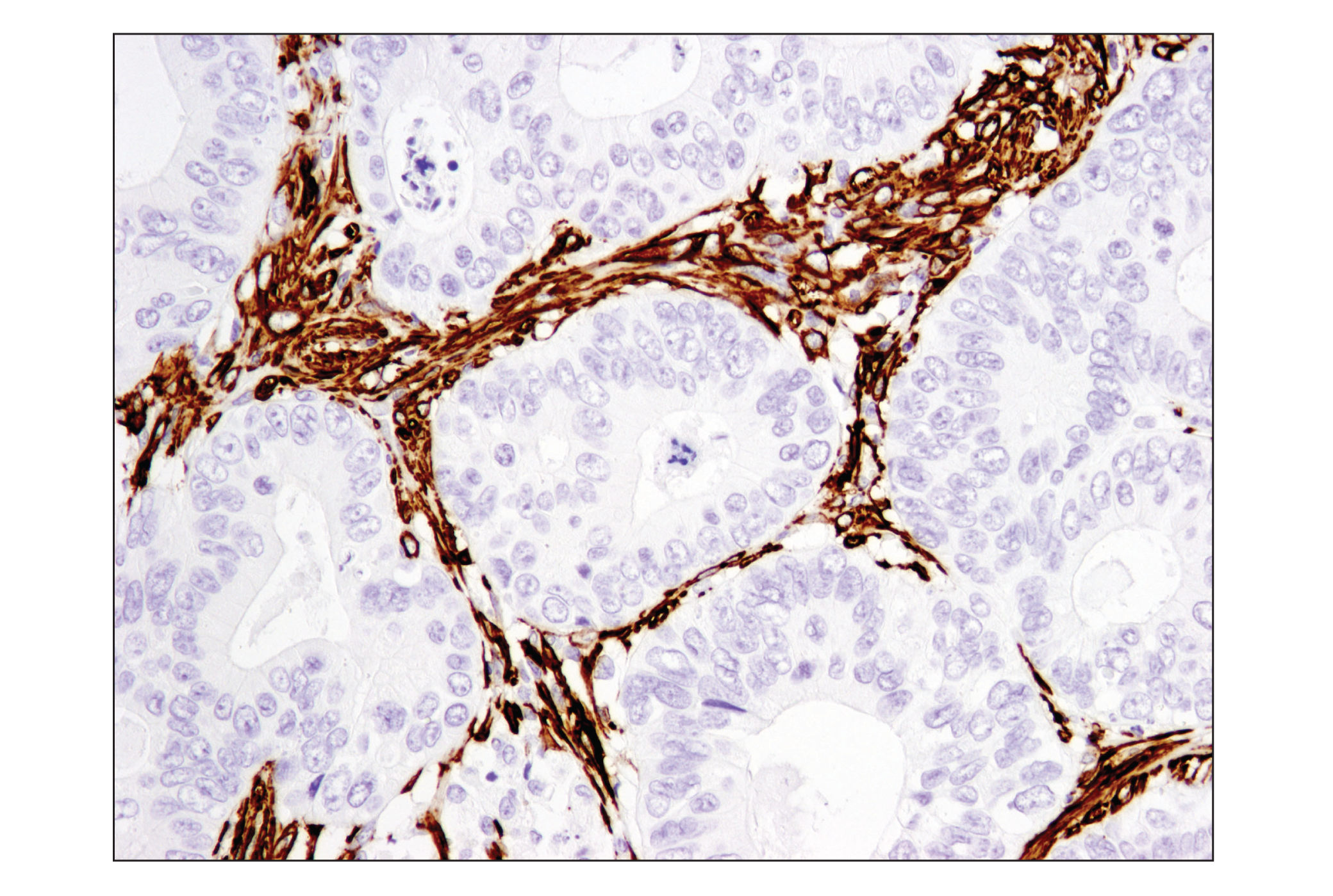 Immunohistochemistry Image 4: α-Smooth Muscle Actin (D4K9N) XP® Rabbit mAb (BSA and Azide Free)