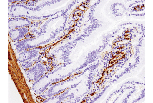 Immunohistochemistry Image 8: α-Smooth Muscle Actin (D4K9N) XP® Rabbit mAb (BSA and Azide Free)
