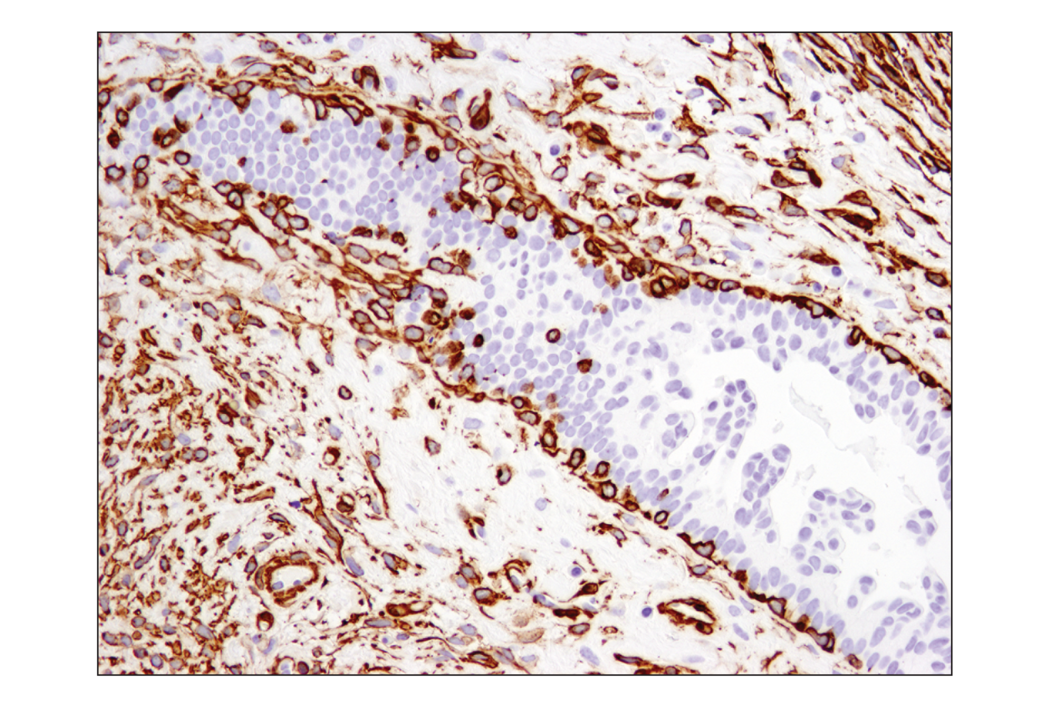 Immunohistochemistry Image 3: α-Smooth Muscle Actin (D4K9N) XP® Rabbit mAb (BSA and Azide Free)