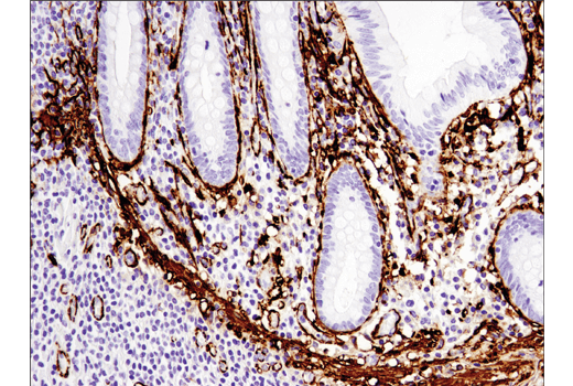 Immunohistochemistry Image 3: α-Smooth Muscle Actin (D4K9N) XP® Rabbit mAb (BSA and Azide Free)