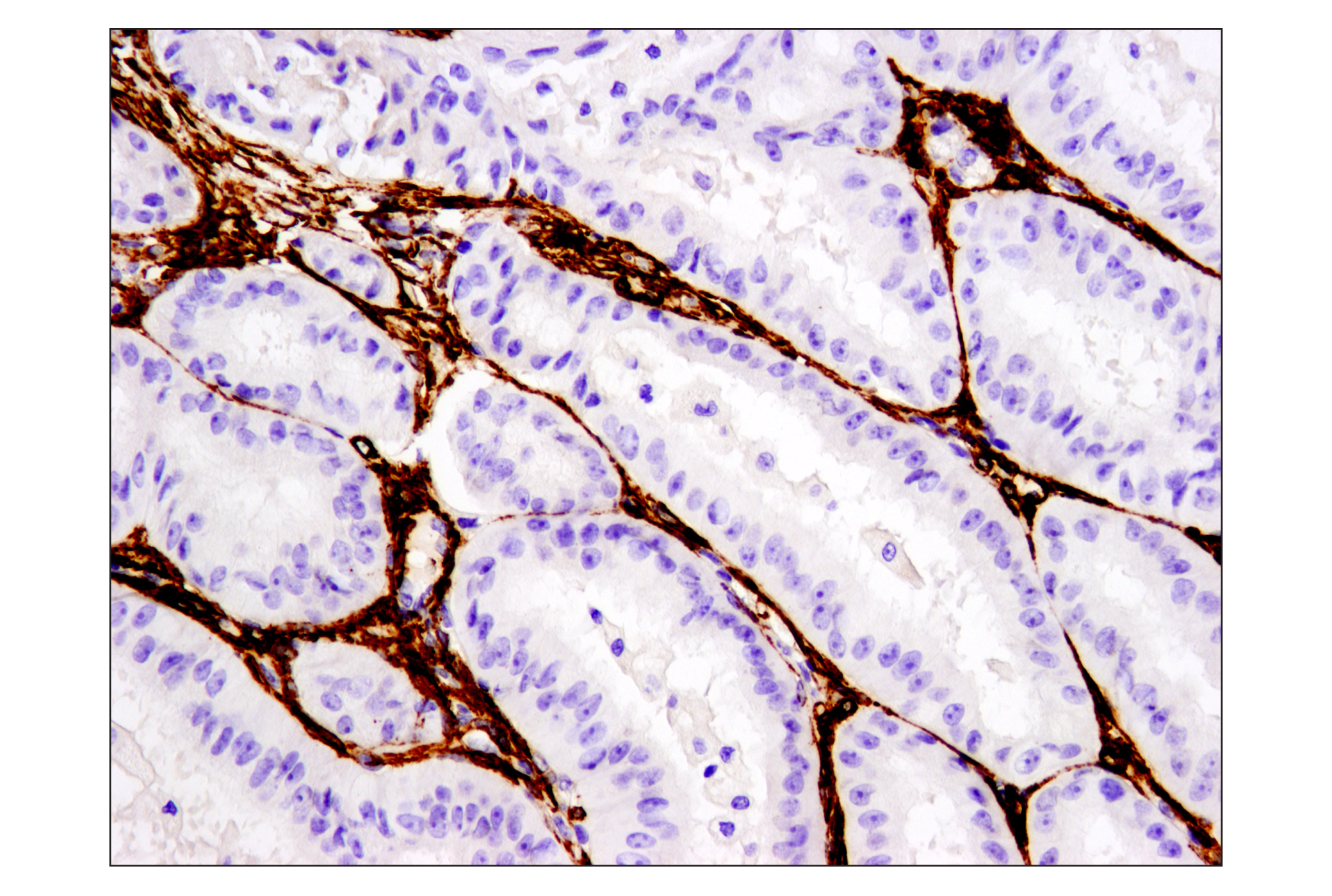 Immunohistochemistry Image 1: α-Smooth Muscle Actin (D4K9N) XP® Rabbit mAb (BSA and Azide Free)