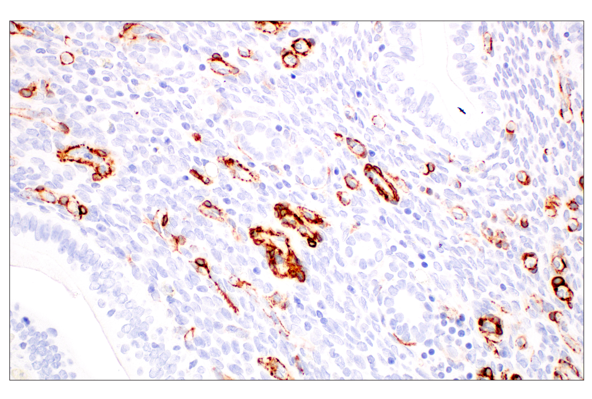 Immunohistochemistry Image 14: α-Smooth Muscle Actin (D4K9N) XP® Rabbit mAb (BSA and Azide Free)
