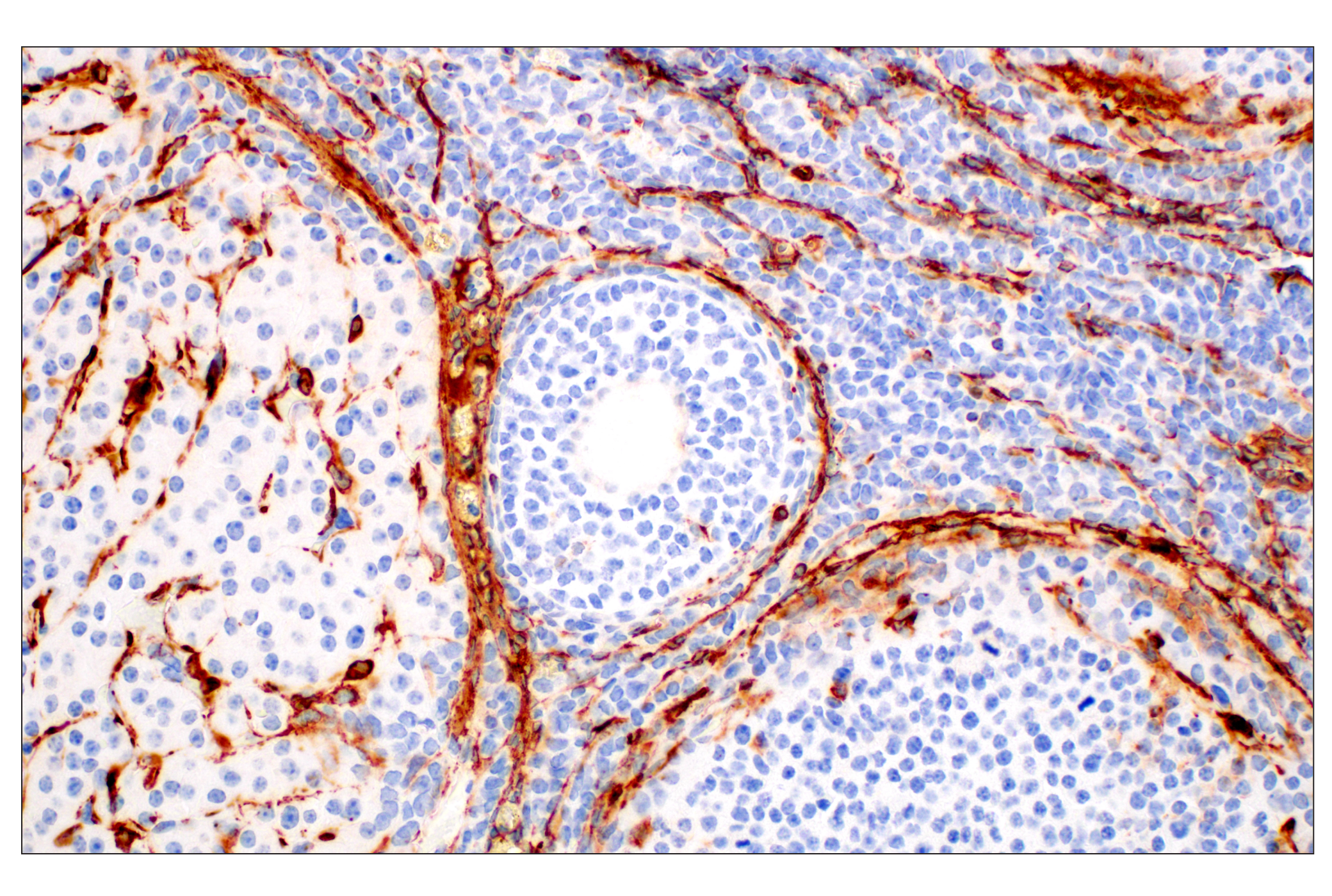 Immunohistochemistry Image 13: α-Smooth Muscle Actin (D4K9N) XP® Rabbit mAb (BSA and Azide Free)