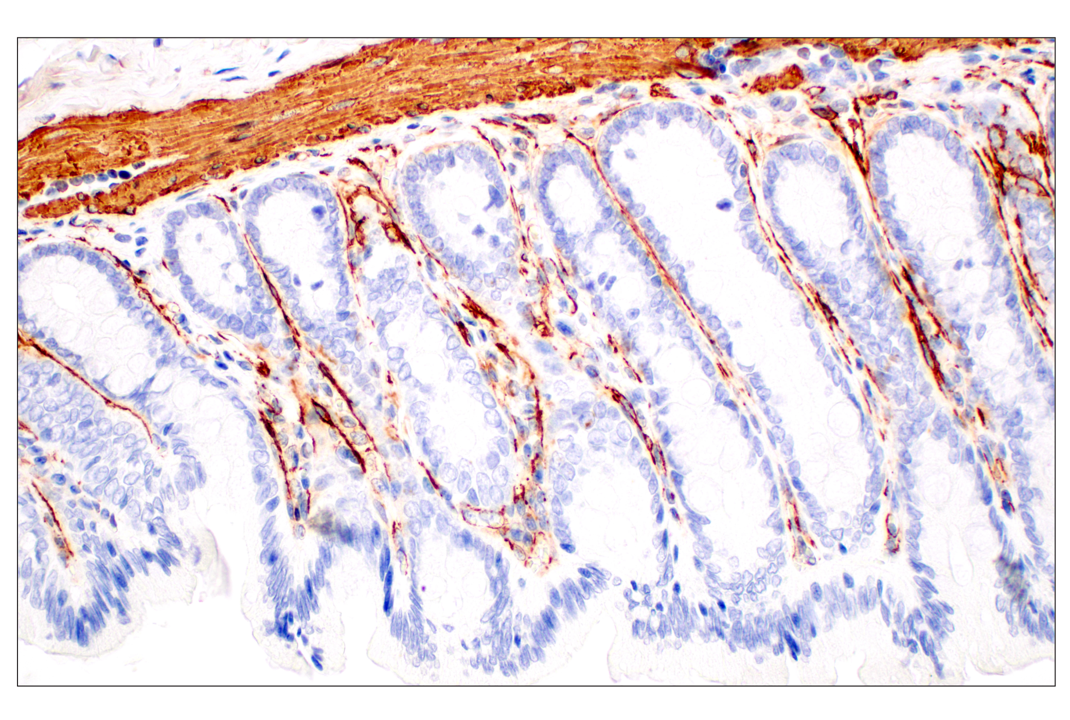 Immunohistochemistry Image 11: α-Smooth Muscle Actin (D4K9N) XP® Rabbit mAb (BSA and Azide Free)