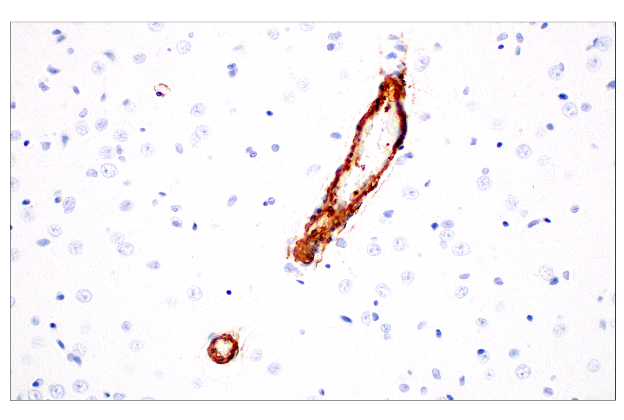 Immunohistochemistry Image 12: α-Smooth Muscle Actin (D4K9N) XP® Rabbit mAb (BSA and Azide Free)