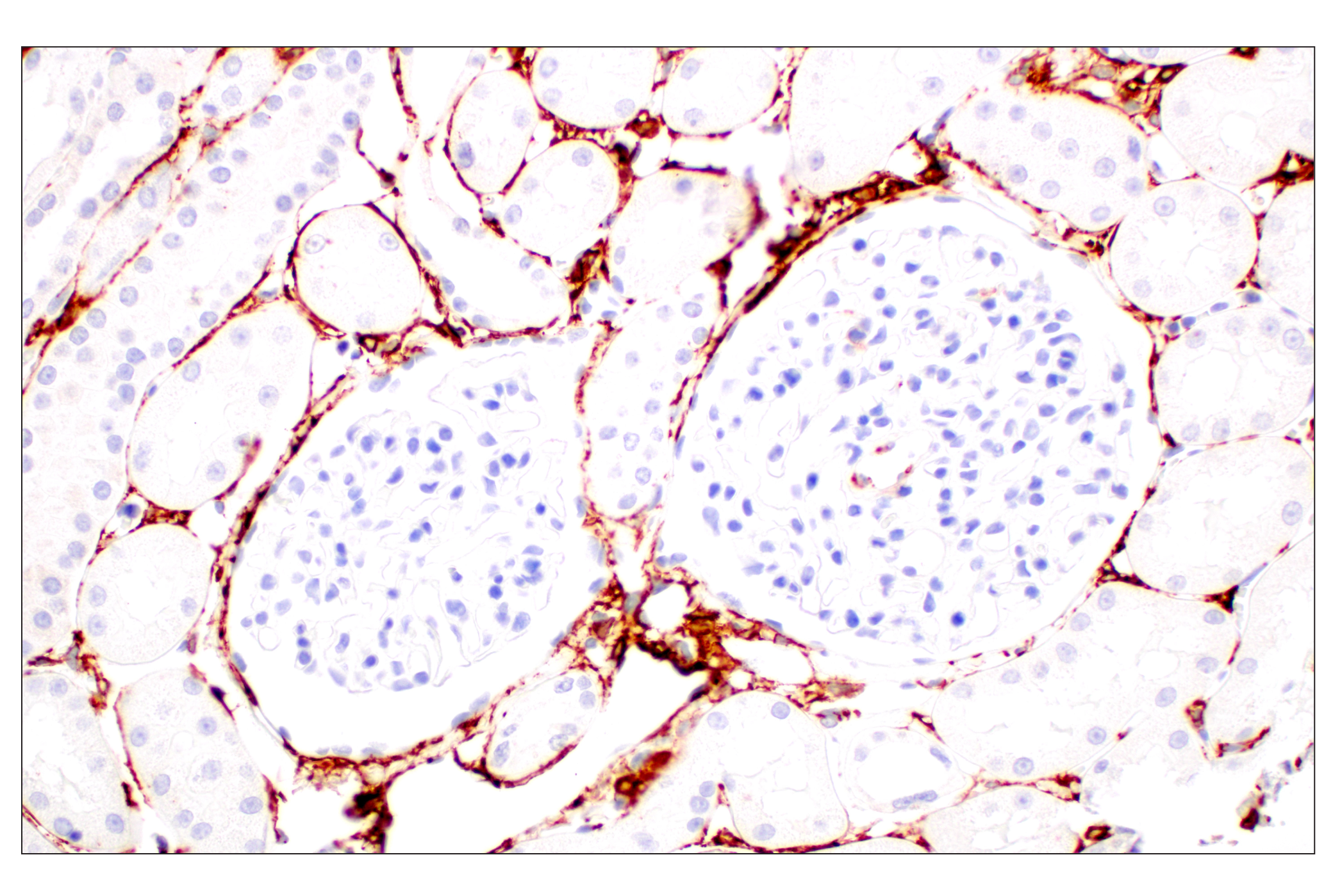 Immunohistochemistry Image 9: α-Smooth Muscle Actin (D4K9N) XP® Rabbit mAb (BSA and Azide Free)