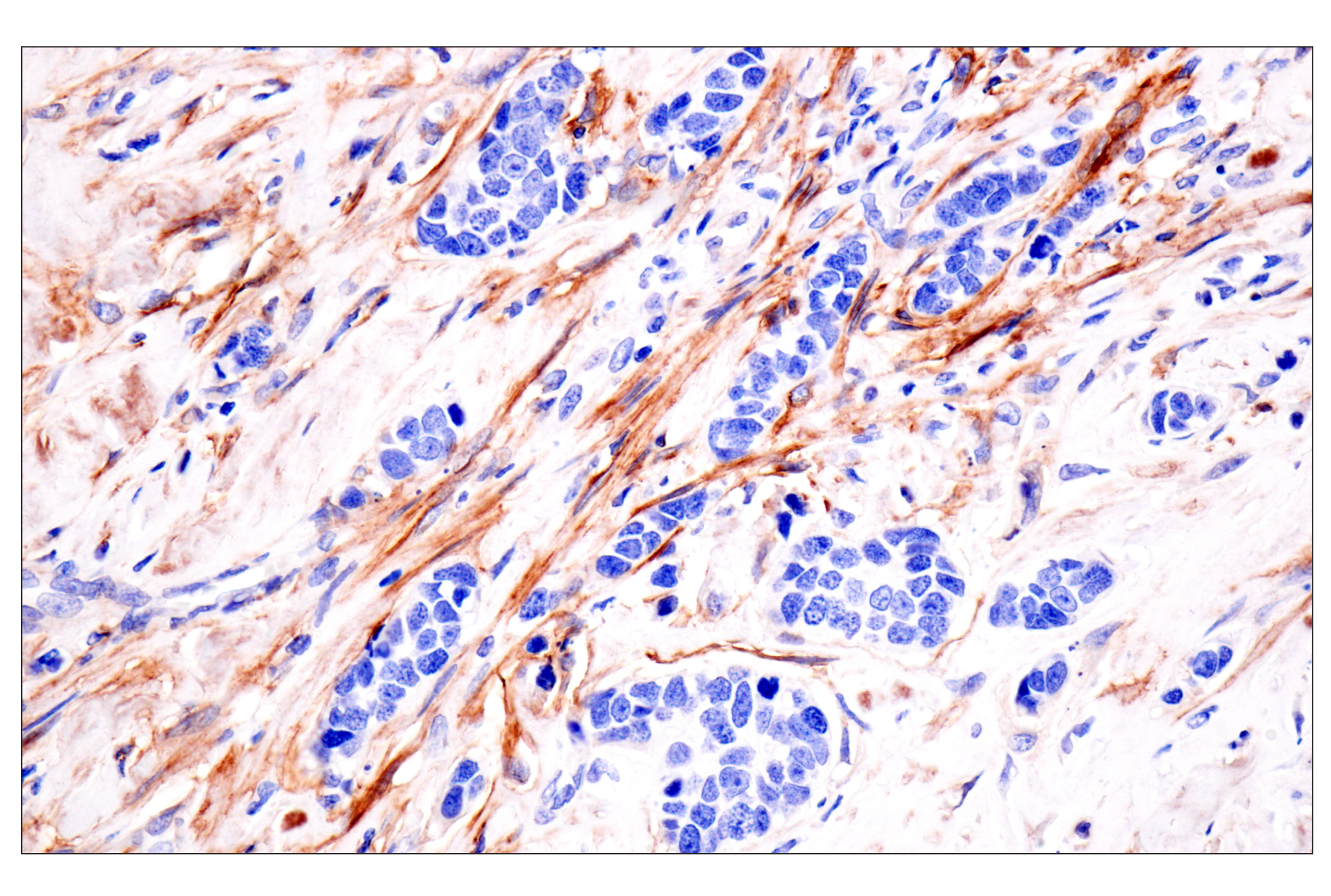 Immunohistochemistry Image 1: LRRC15 (E4X8J) Rabbit mAb