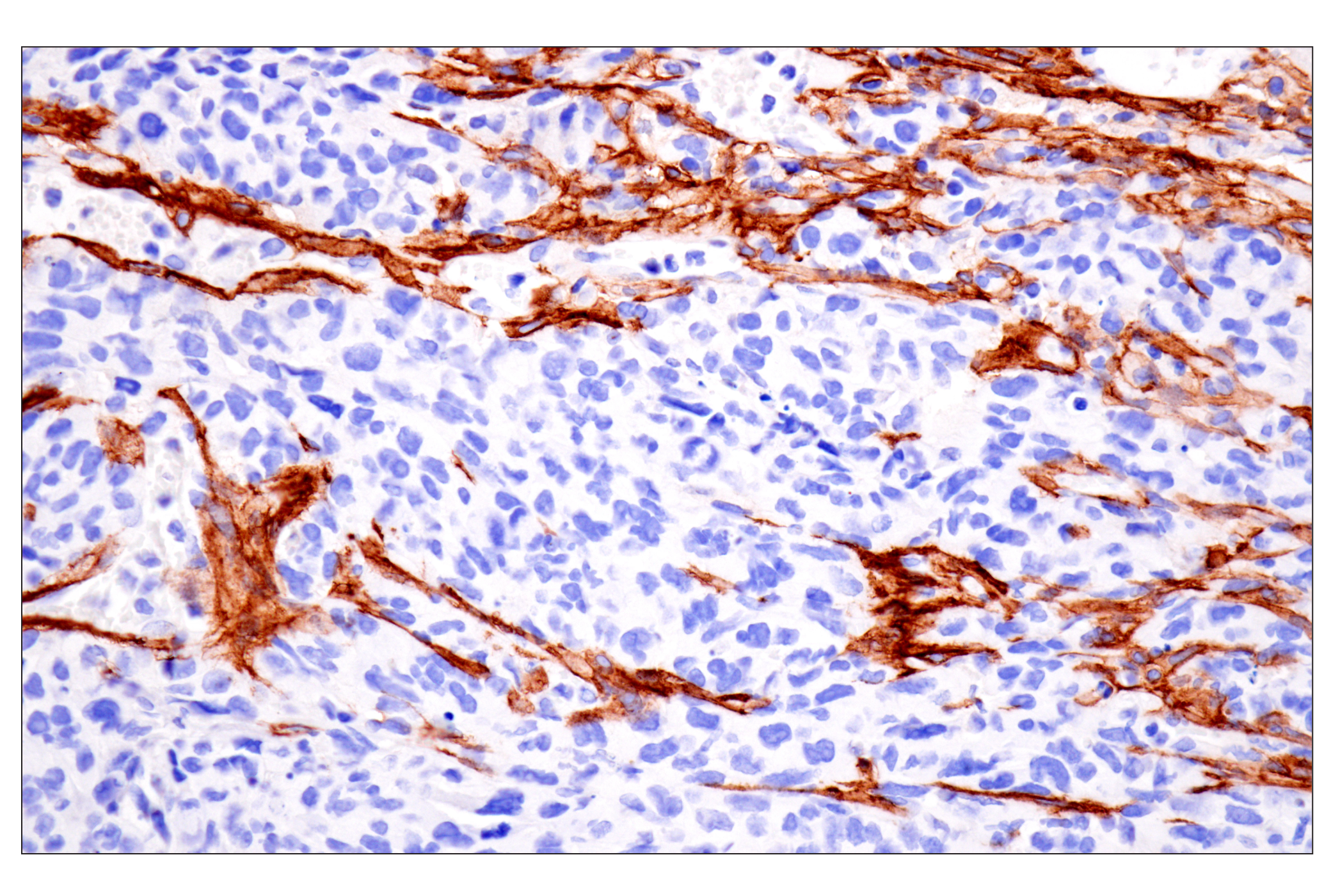 Immunohistochemistry Image 8: LRRC15 (E4X8J) Rabbit mAb