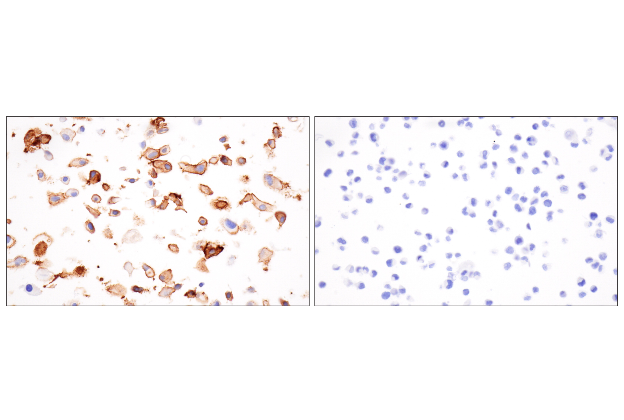 Immunohistochemistry Image 11: LRRC15 (E4X8J) Rabbit mAb