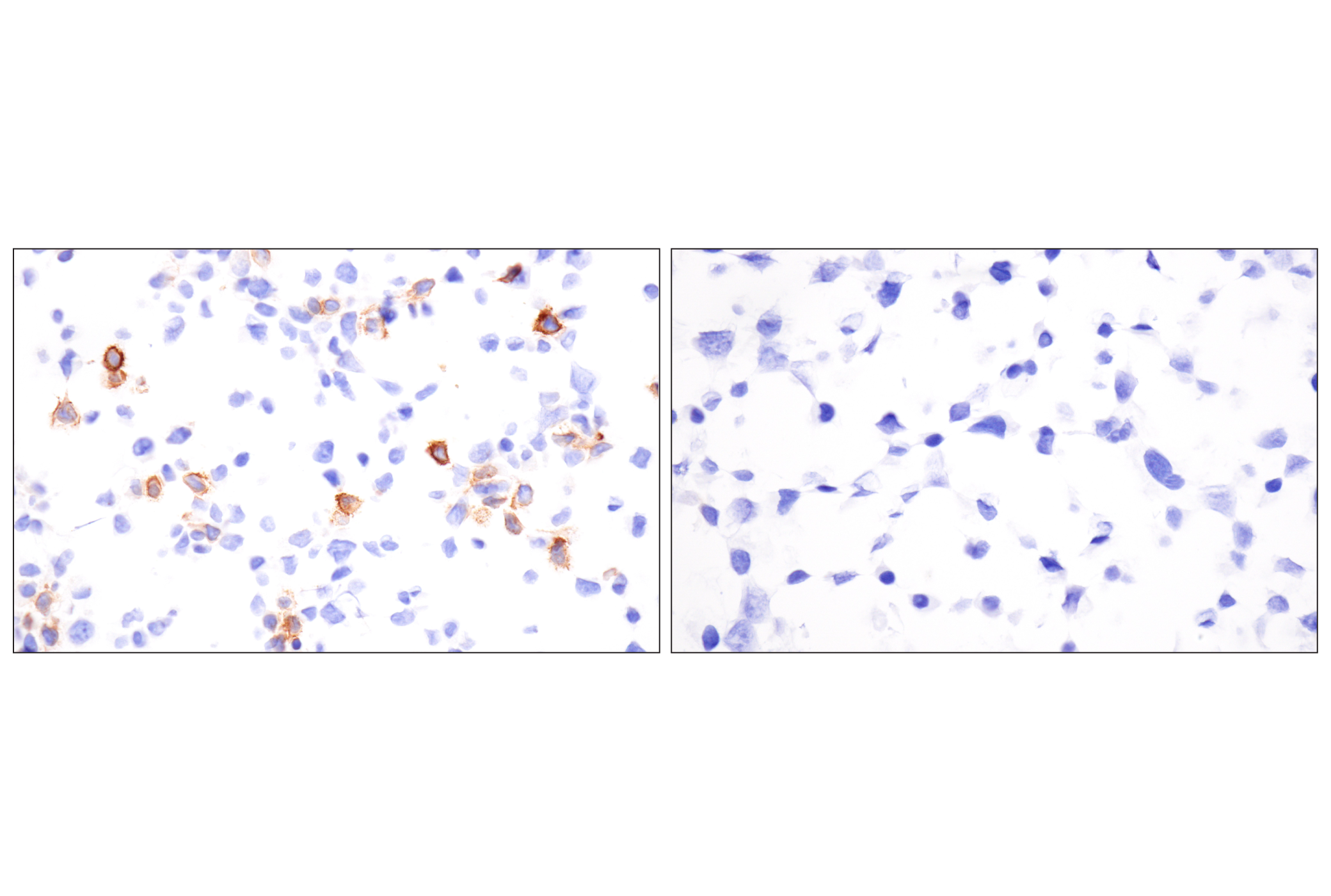 Immunohistochemistry Image 12: LRRC15 (E4X8J) Rabbit mAb