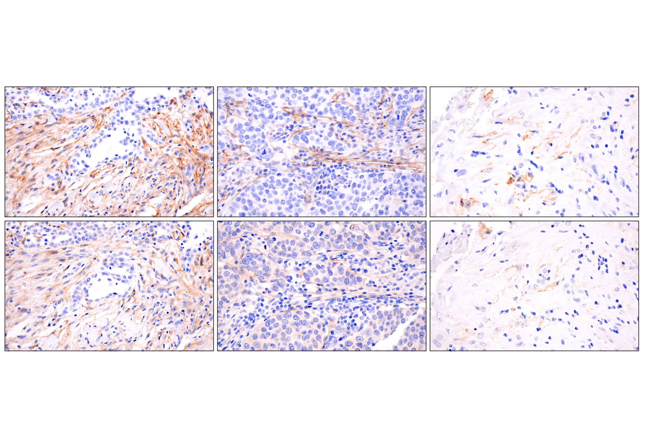 Immunohistochemistry Image 9: LRRC15 (E4X8J) Rabbit mAb