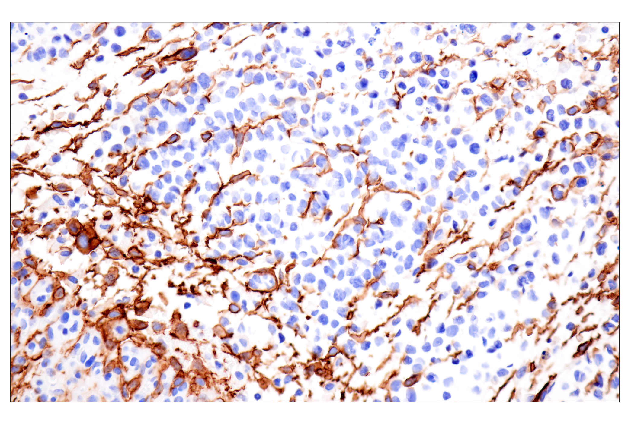 Immunohistochemistry Image 7: LRRC15 (E4X8J) Rabbit mAb