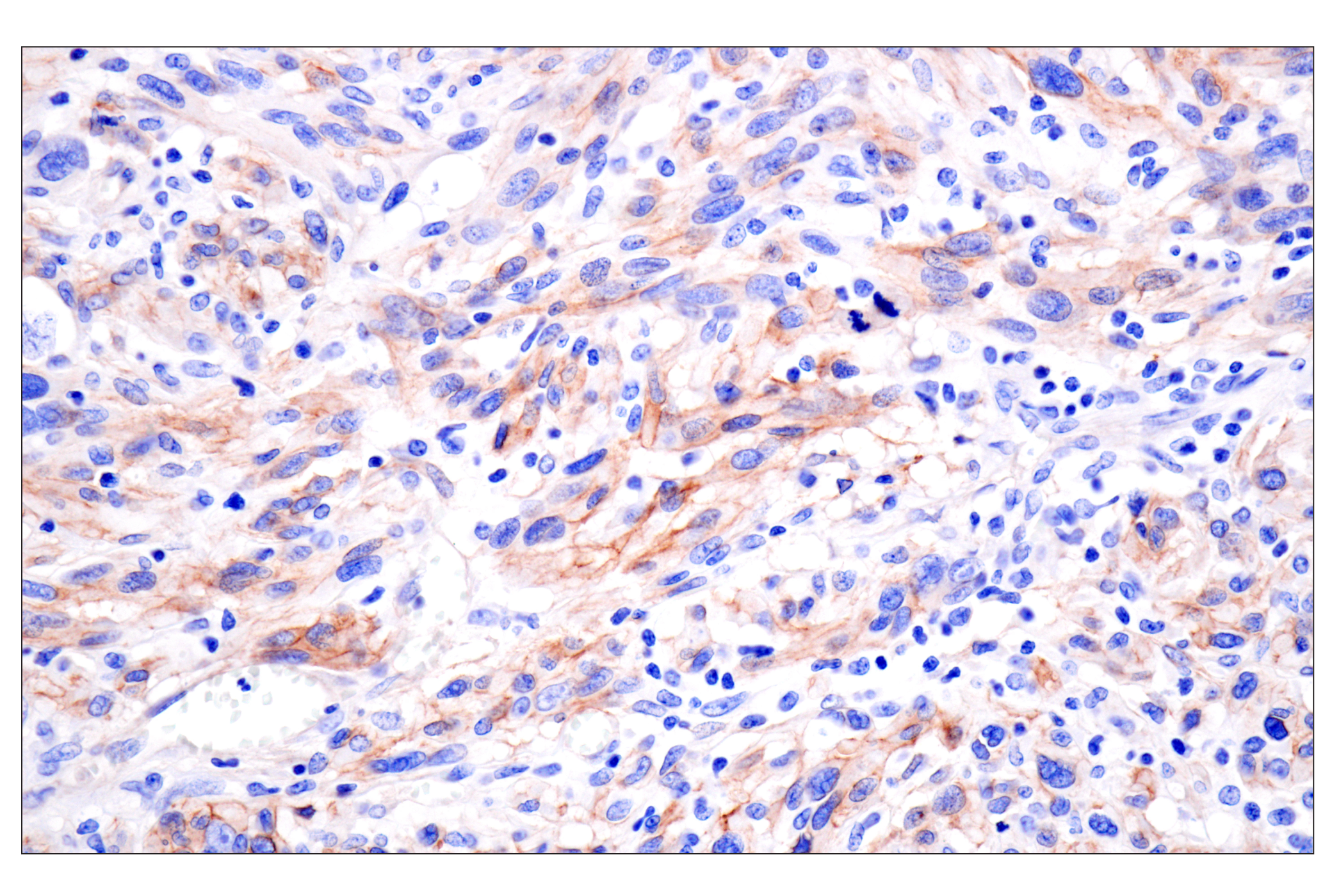 Immunohistochemistry Image 3: LRRC15 (E4X8J) Rabbit mAb