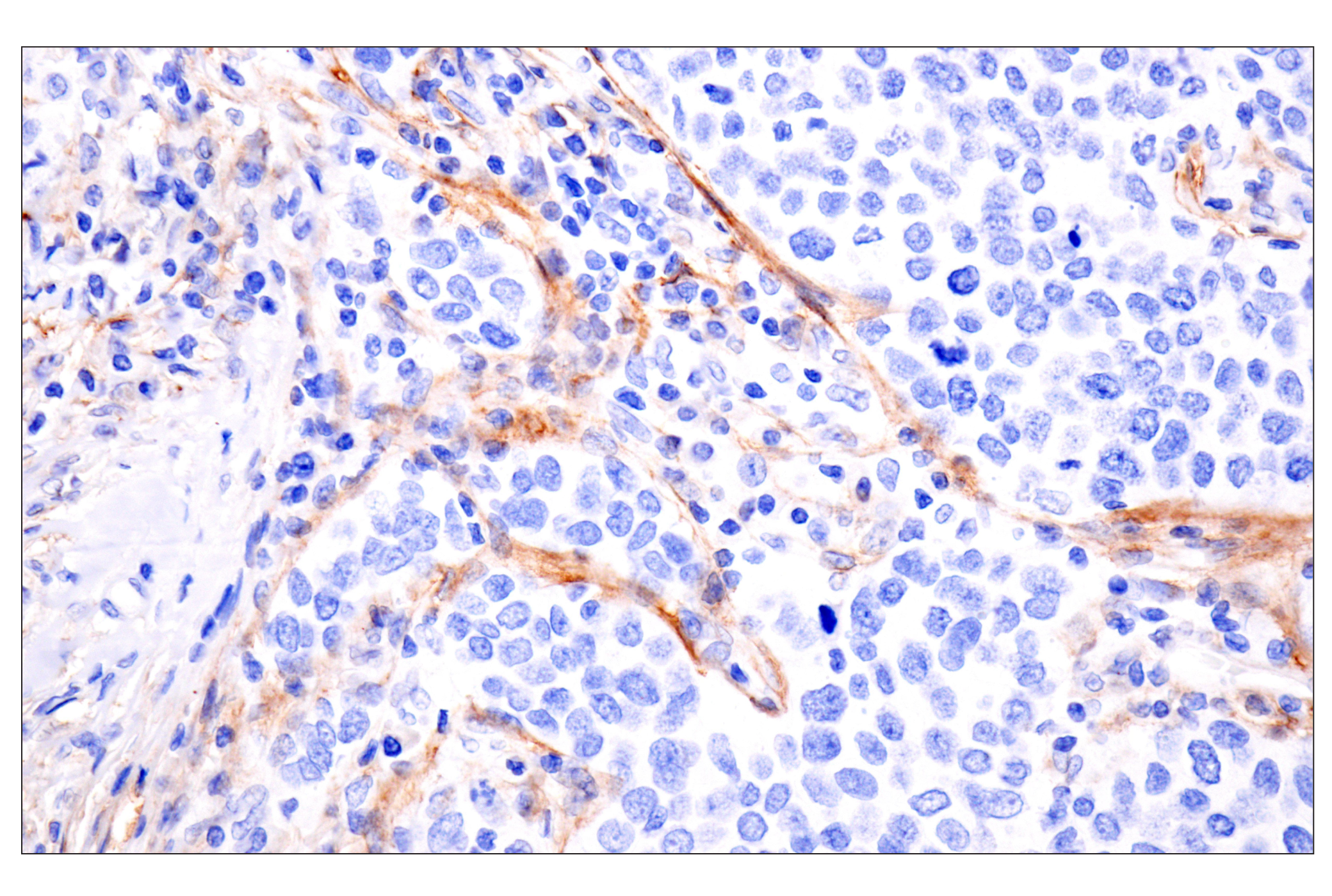 Immunohistochemistry Image 2: LRRC15 (E4X8J) Rabbit mAb