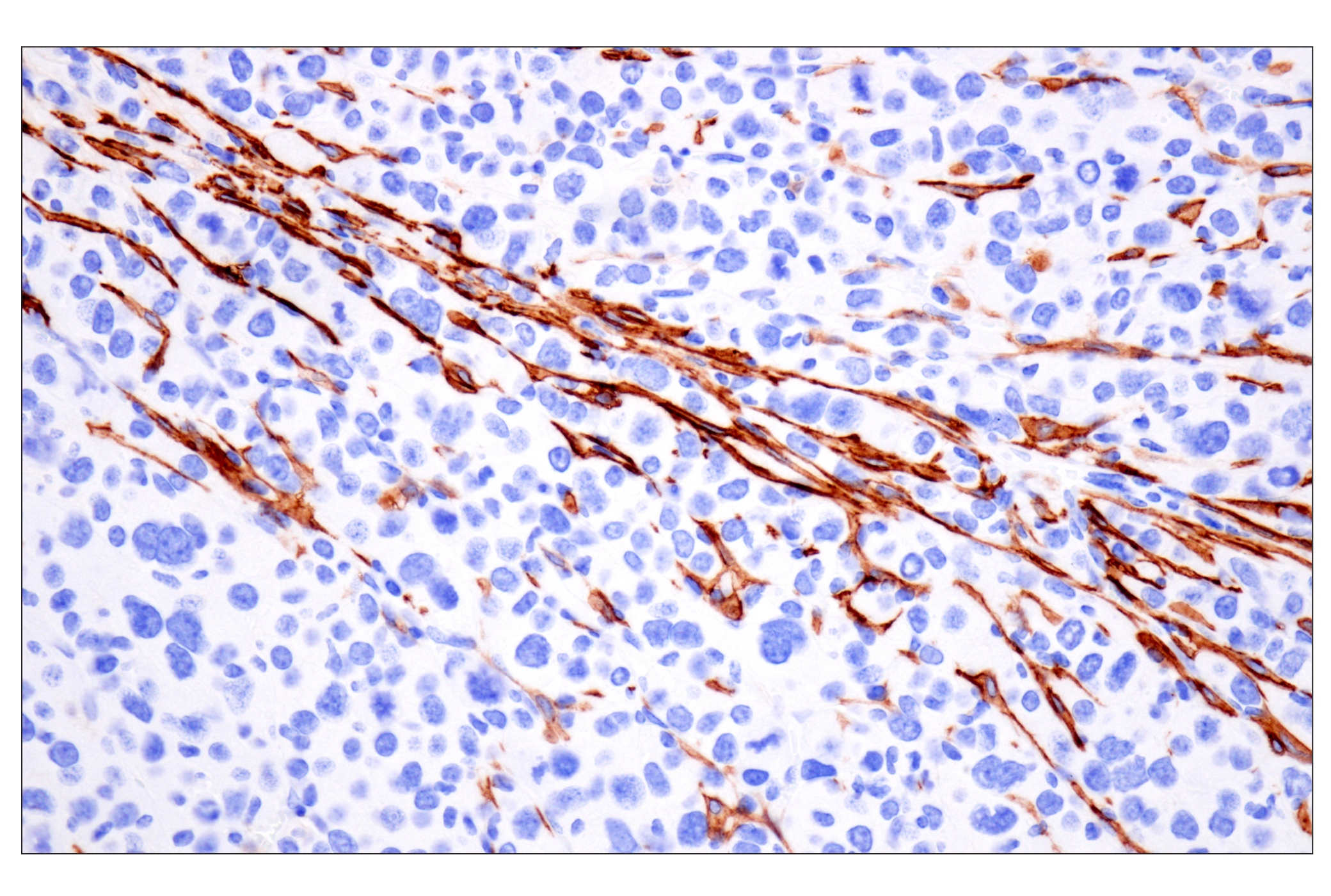 Immunohistochemistry Image 6: LRRC15 (E4X8J) Rabbit mAb