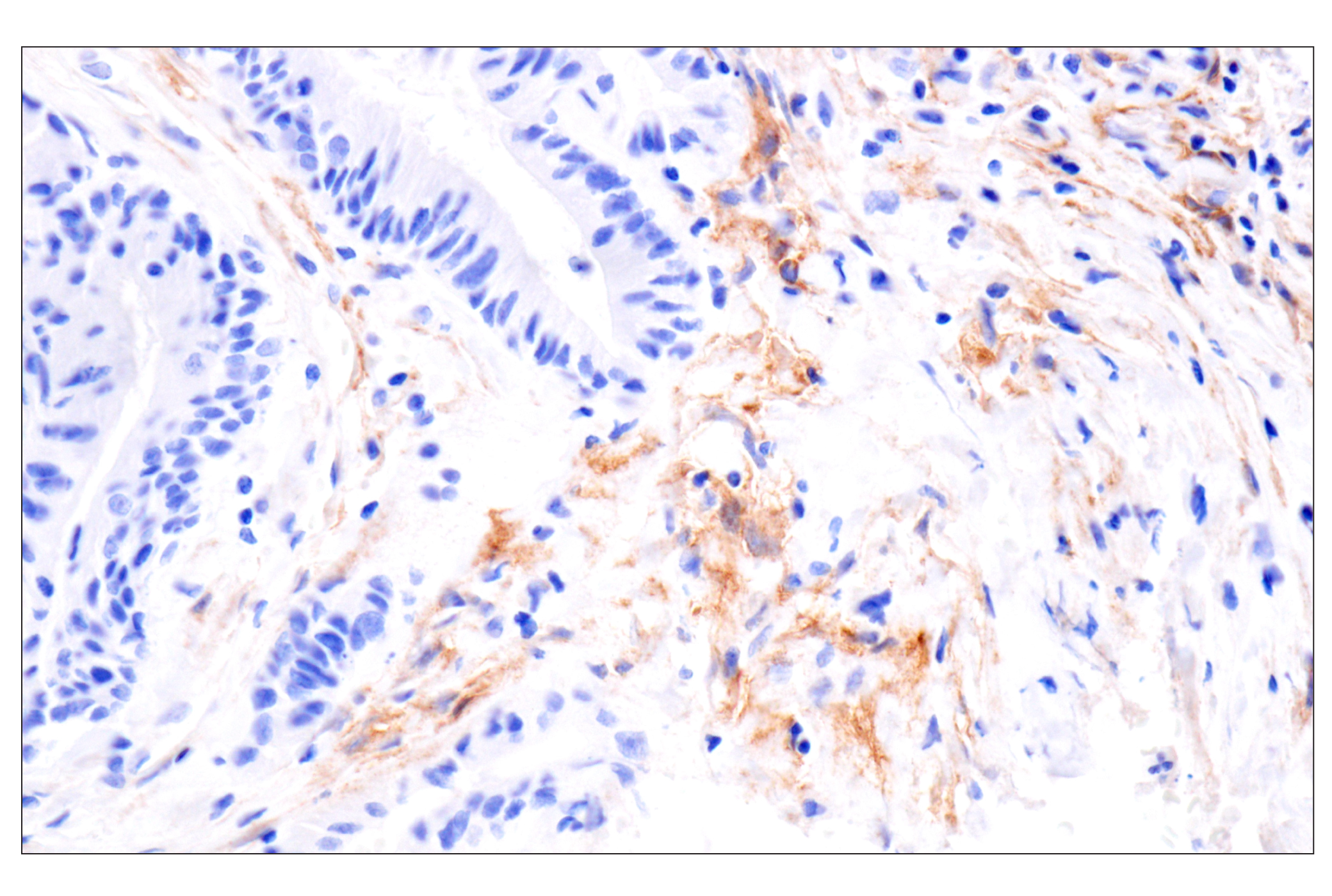Immunohistochemistry Image 4: LRRC15 (E4X8J) Rabbit mAb