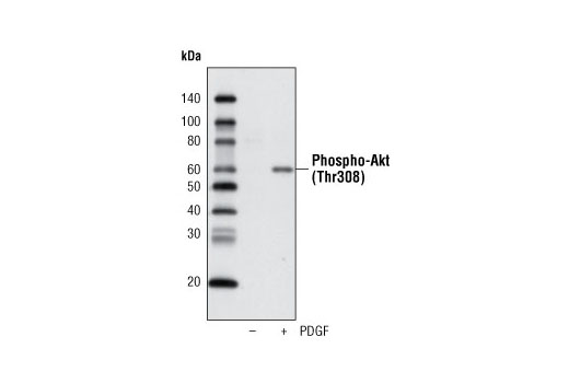 Western Blotting Image 1: Phospho-Akt (Thr308) (C31E5E) Rabbit mAb (Biotinylated)